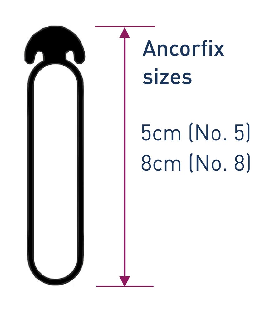 Ancorfix tying bands